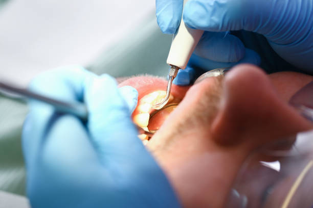 Best Emergency Tooth Extraction  in Crossville, AL