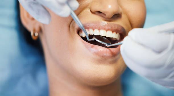 Best Knocked-Out Tooth Emergency  in Crossville, AL